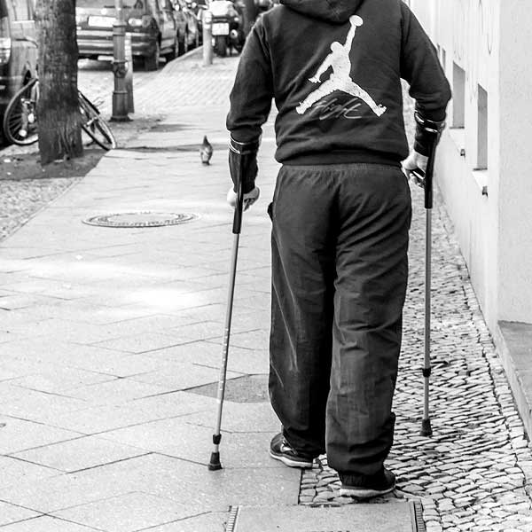 Kopf in Gips